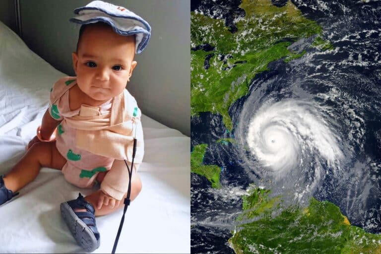 latin american baby after completing corrective surgery for erb's palsy and a satellite image of hurricane maria passing over the caribbean and puerto rico