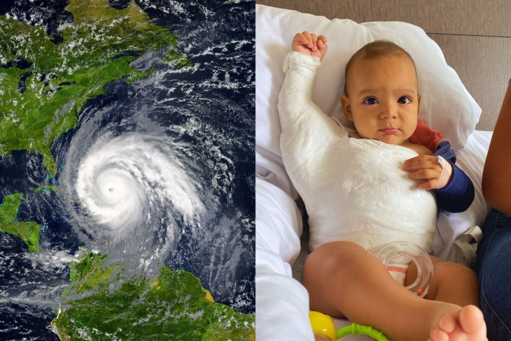 latin american baby after completing corrective surgery for erb's palsy and a satellite image of hurricane maria passing over the caribbean and puerto rico