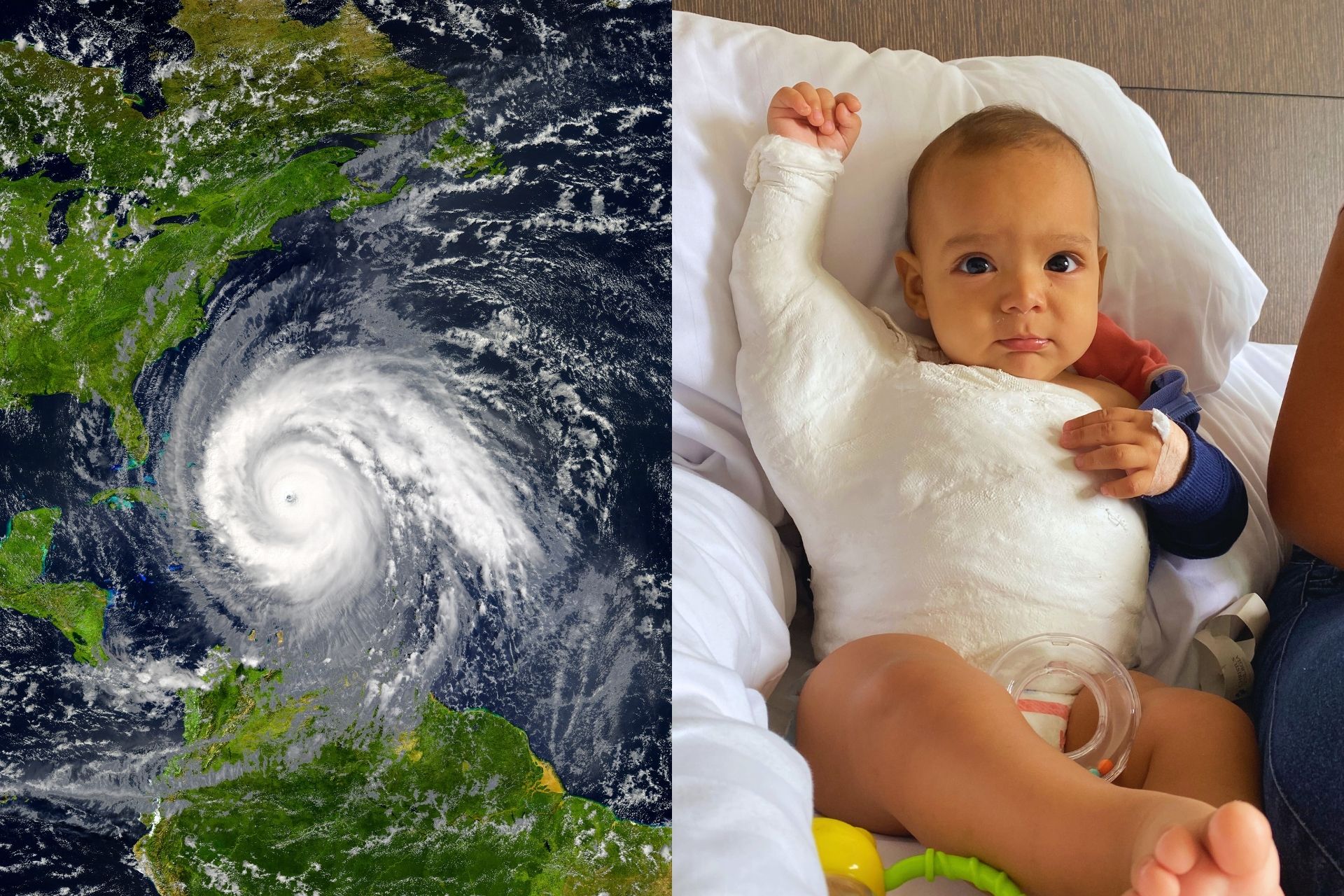 latin american baby after completing corrective surgery for erb's palsy and a satellite image of hurricane maria passing over the caribbean and puerto rico